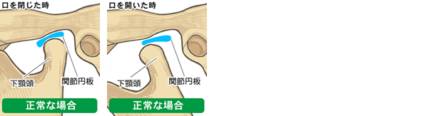 正常な顎関節